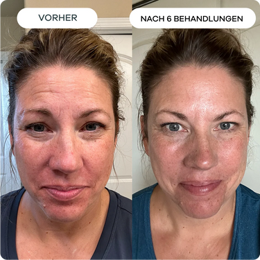 Feine Linien & Falten