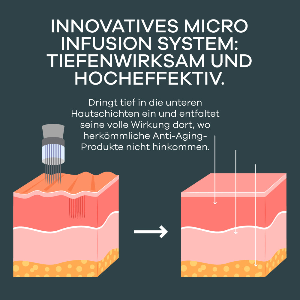 Seranova Micro-Infusion System™ - Seranova DE